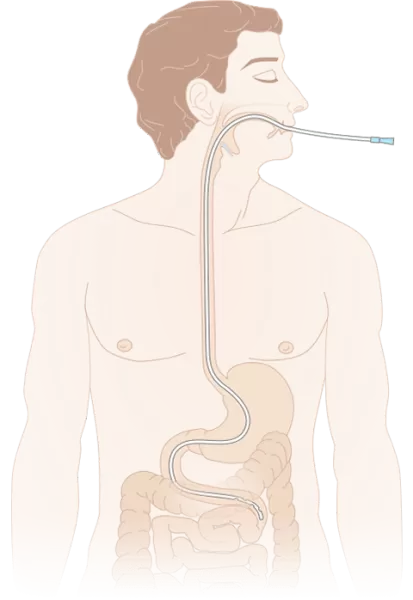 Зонд (катетер) дуоденальный с РКП MEDEREN 125 см закрытый конец 